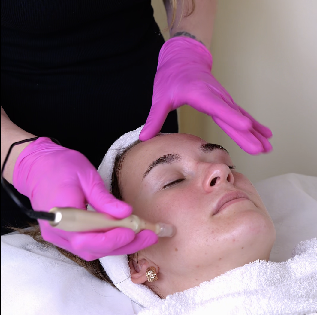 Professionell microneedling-behandling